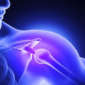 Consulta médica evaluando tendinitis antes de definir un tratamiento con terapia celular